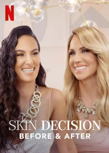 Skin Decision: Before and After - Saison 1 - VF HD